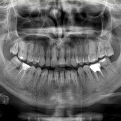 Pagina Radiografia Dentale1